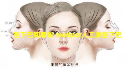 垫下巴和磨骨 medpor人工骨垫下巴